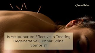 Is Acupuncture Effective in Treating Low Back Pain [upl. by Acinna]