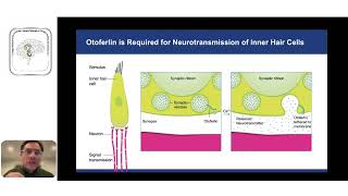 Terapia Genética para pacientes con sordera profunda causada por mutaciones del Gen de Otoferlina [upl. by Dragde]