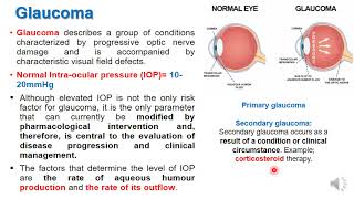 Treatment of Glucoma and eye drugs [upl. by Alleras]