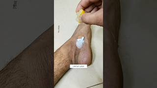 Get Fair Feet In 5min  Most Easy Pedicure  Easy SunTan Removal Pack At Home feet ytviral shorts [upl. by Katrina]