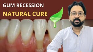 How to use ALOE VERA for Teeth and Gums  Aloe Vera for Gum Recession [upl. by Ume725]