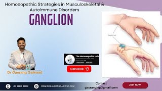 Homoeopathic Strategies in Ganglion Dr Gaurang Gaikwad [upl. by Walrath397]