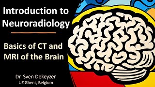 Basics of CT and MRI of the brain introduction to Neuroradiology [upl. by Duma]