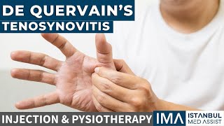 De Quervains Tenosynovitis  Injection and Physiotherapy [upl. by Kraul225]