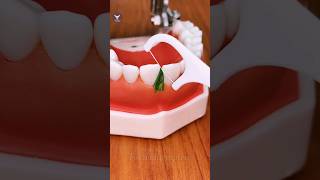 Amazing gadget for cleaning teeth [upl. by Lurette]