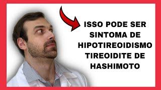 Tireoidite de Hashimoto e Hipotireoidismo  Sintomas e causas [upl. by Ahseikram]