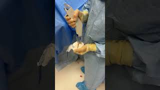 Orthopedic surgery operationtheatre operationtheatretechnician orthopedics shorts [upl. by Dace813]