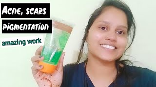 acne scars pigmentation ।।alovera gel benefits for skin glowing।।patanjali aloevera gel review।। [upl. by Anemolif]