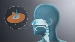 Provent Therapy Mechanism of Action How EPAP Works [upl. by Tartaglia456]