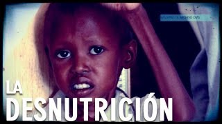 La desnutrición Documental Completo [upl. by Elonore947]