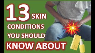 13 Skin Conditions You Should Know About [upl. by Pierrette]