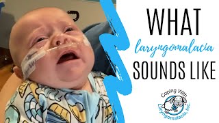 What Laryngomalacia Sounds Like  noisy breathing  newborn congestion [upl. by Ennairrek]