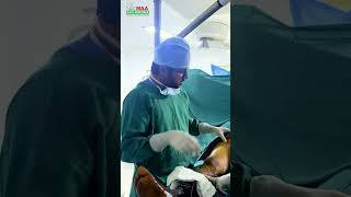 Varicose Veins Treatment maahospitals maaent EndovenousLaserTreatment shorts youtubeshorts [upl. by Costanzia]