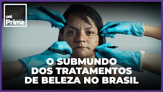 Do botox ao PMMA Brasil é paraíso de intervenções que são caso de polícia [upl. by Emil544]