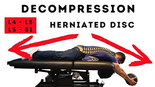 Best Decompression for lumbar herniated disc [upl. by Windham]