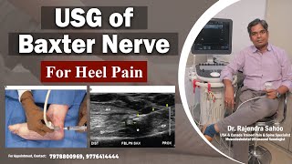 The USG of The Baxter Nerve For Heel Pain  Heel Pain Treatment  Dr Rajendra Sahoo [upl. by Nodnil862]