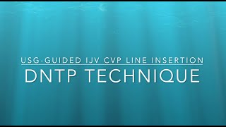 CVP line Insertion using DNTP technique Ultrasound guided central line insertion [upl. by Airdnaz]