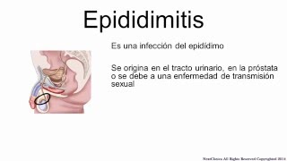 Epididymitis Spanish [upl. by Hamlen474]