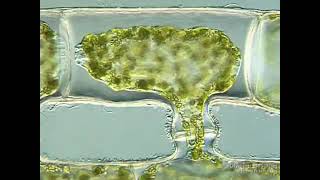 Scalariform Conjugation in Spirogyra [upl. by Donella]