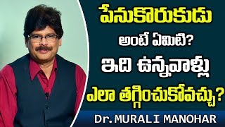 పేనుకోరుకుడు అంటే ఏమిటి ఇది వున్నవాళ్లు ఎలా తగ్గించుకోవచ్చు Alopecia  Dr Murali Manohar [upl. by Auqcinahs968]