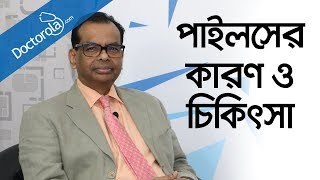 পাইলস রোগের কারন লক্ষন ও চিকিৎসা Piles treatment in Bangladesh [upl. by Edwine522]