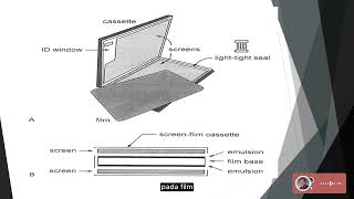 Radiofotografi  Intensifying Screen IS [upl. by Ehtyde]