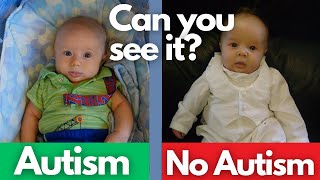 12 Signs of Autism in Babies [upl. by Marmion]