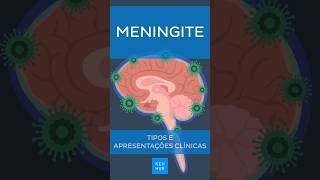 Meningite Tipos e sintomas  Kenhub meningite [upl. by Ahsiatal]