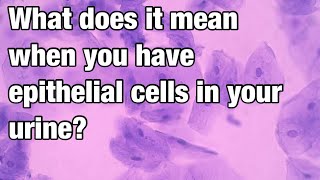 What does it mean when you have epithelial cells in your urine [upl. by Tselec]