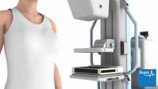 How a mammogram is carried out  Bupa Health [upl. by Magnusson]