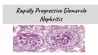 Rapidly Progressive Glomerulonephritis  RPGN [upl. by Keir760]