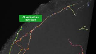 Neurolucida 360 How to detect and edit varicosities v2018 [upl. by Filler]