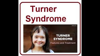 Turner Syndrome Key Facts  2024 [upl. by Ennylcaj949]