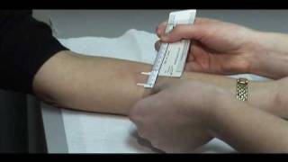 TB Skin Test  Mantoux Method [upl. by Mastat]