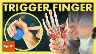 What is Trigger Finger and How Do I Fix It Stenosing Tenosynovitis [upl. by Thorn]