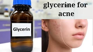 glycerine for acne amp glowing skinglycerine benefitshorts [upl. by Nivac119]