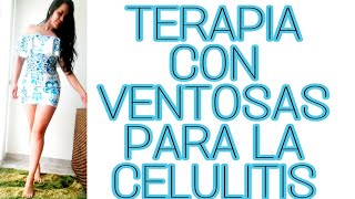 Terapia con ventosas para la celulitis en casa [upl. by Aissat762]