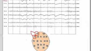 EEG  101 [upl. by Releyks]