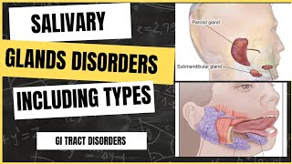 Salivary glands disorders  Understanding causes symptoms and treatment [upl. by Wenona]