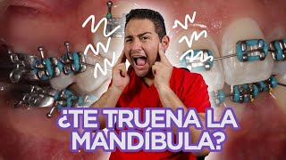 😖 ”ME TRUENA LA MANDÍBULA” 😖 ¡DEBERÍAS VER ESTE VIDEO😍 🔥CASO de CHASQUIDOS RESUELTO en 2021🔥 [upl. by Dust]