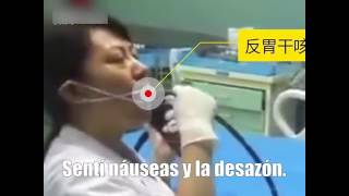 Una doctora se hace una gastroscopia a sí misma para conocer las sensaciones de los enfermos [upl. by Kcyred931]