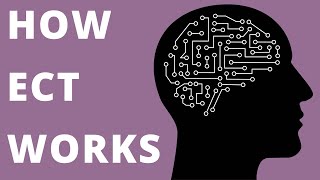 How ECT Works electroconvulsive therapy [upl. by Adnylg]