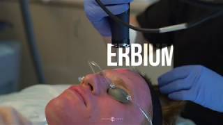 Erbium Fractional Laser  Live with Dr Jason Emer [upl. by Lynnet]