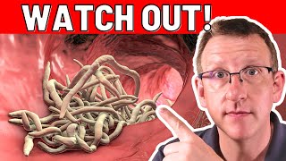 10 TOP early warning signs of PARASITES ACT RIGHT NOW [upl. by Bostow281]