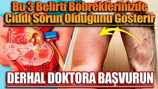 Bu 3 Belirti Böbreklerinizde Ciddi Sorun Olduğunu Gösterir Derhal Doktora Başvurun [upl. by Cari]