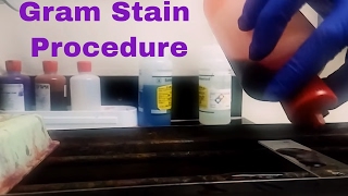 Microbiology Gram Stain Procedure Explained [upl. by Macintyre]