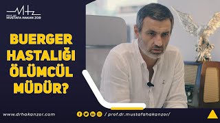 Buerger Hastalığı Ölümcül müdür  Buerger Hastalığı Tedavisi var mı [upl. by Dorej395]