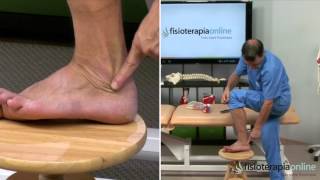 Tratamiento de la tendinitis de los peroneos  Fisioterapia Bilbao [upl. by Dlorrej852]