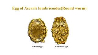 Ascaris lumbricoides egg morphology characteristics and identification [upl. by Merkley580]