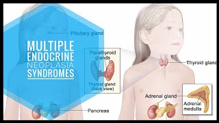 Multiple Endocrine Neoplasia  Rapid Review [upl. by Eneloc]